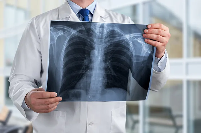 Soal Tes Masuk RADIOLOGI